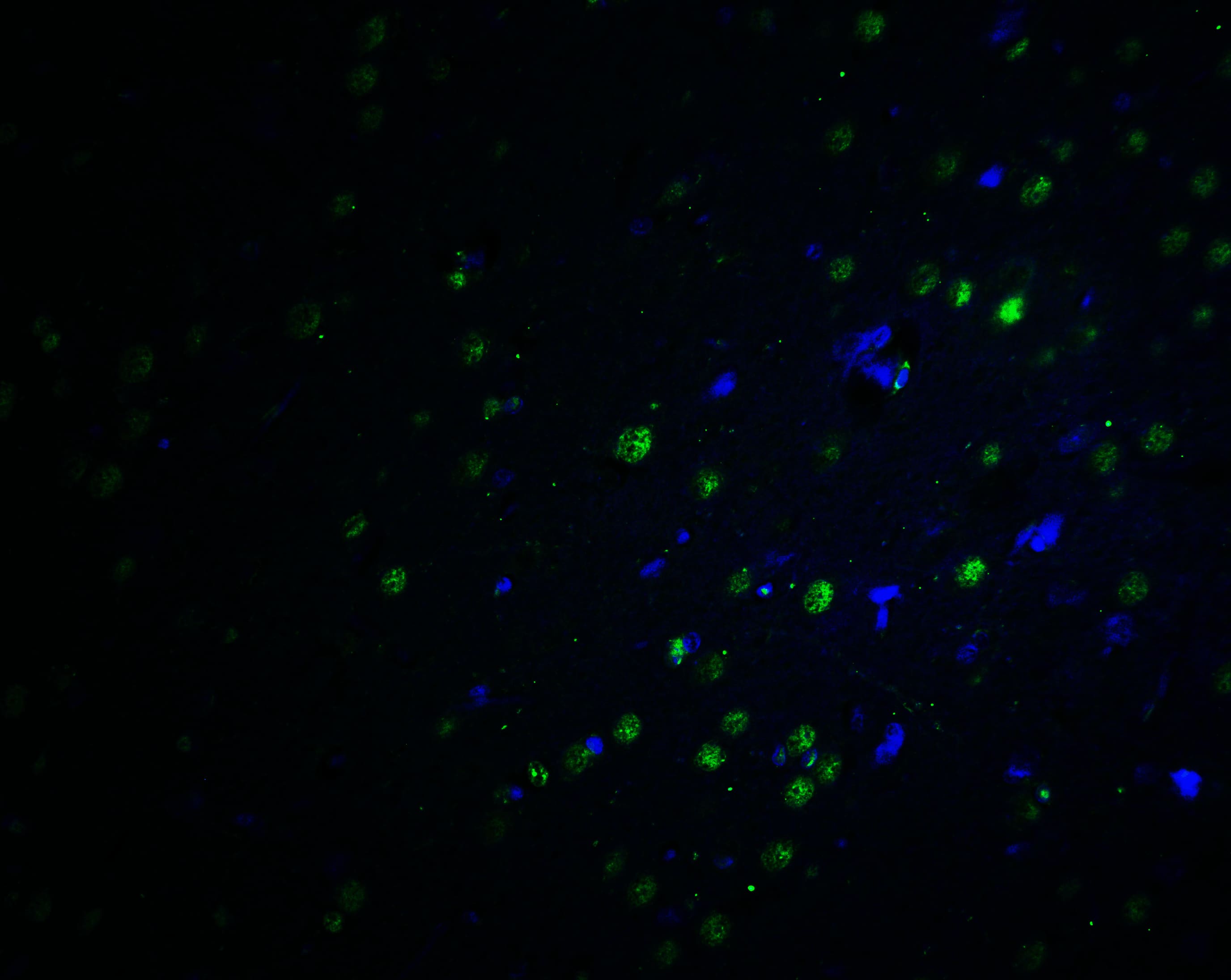 Immunocytochemistry/ Immunofluorescence: PLAGL2 Antibody - BSA Free [NBP2-81930] - Immunofluorescence of PLAGL2 in rat brain tissue with PLAGL2 antibody at 20 u/ml.Green: PLAGL2 Antibody   Blue: DAPI staining