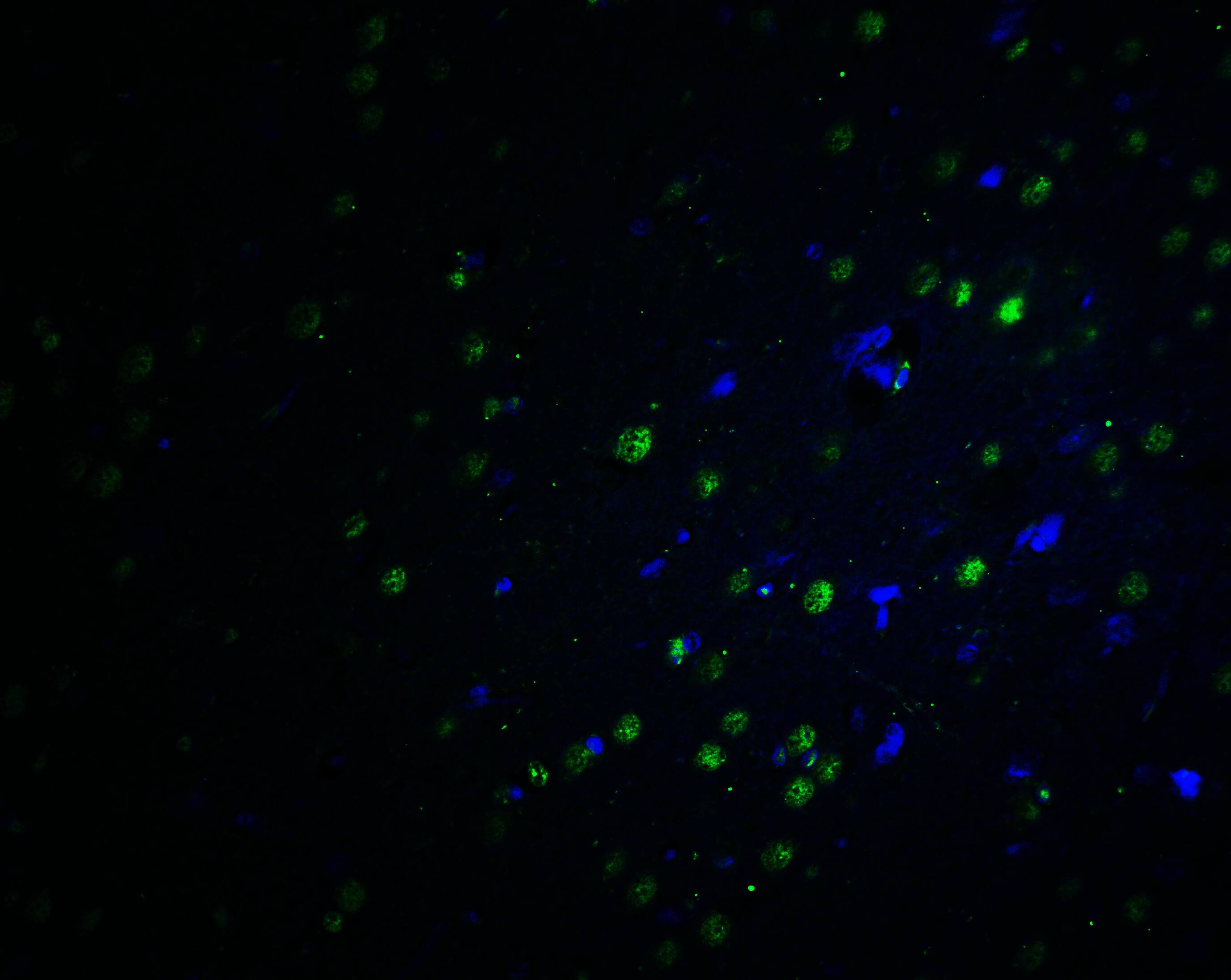 Immunocytochemistry/ Immunofluorescence: PLAGL2 Antibody - BSA Free [NBP2-81930] - Immunofluorescence of PLAGL2 in rat brain tissue with PLAGL2 antibody at 20 u/ml.Green: PLAGL2 Antibody   Blue: DAPI staining