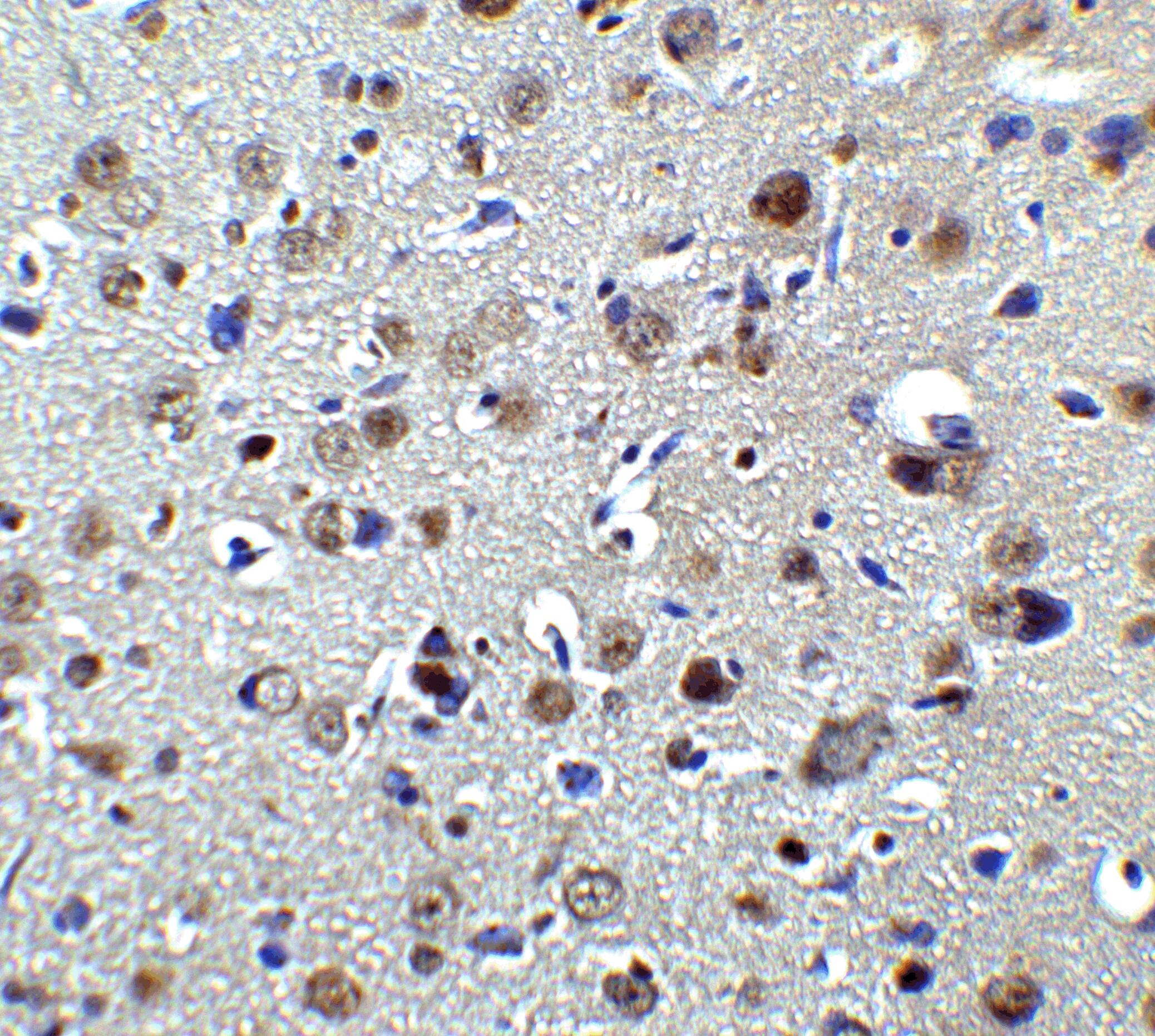 Immunohistochemistry: PLAGL2 Antibody - BSA Free [NBP2-81930] - Immunohistochemistry of PLAGL2 in rat brain tissue with PLAGL2 antibody at 2 u/ml.