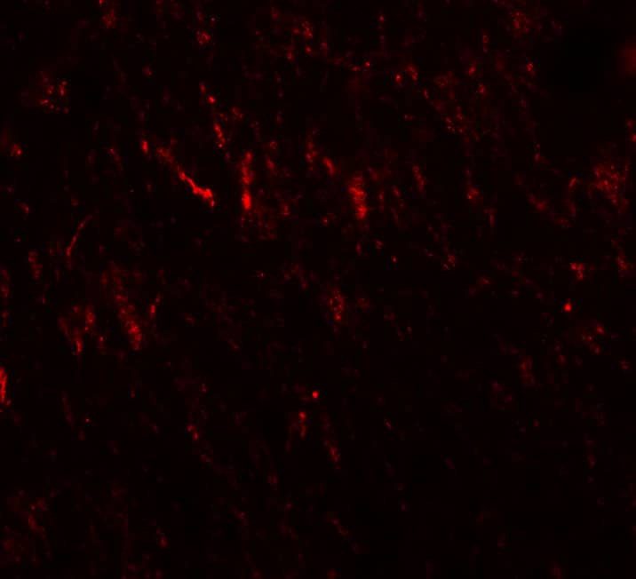 Immunocytochemistry/ Immunofluorescence: PRICKLE2 Antibody - BSA Free [NBP2-81938] - Immunofluorescence of PRICKLE2 in rat brain cells with PRICKLE2 antibody at 20 u/mL.