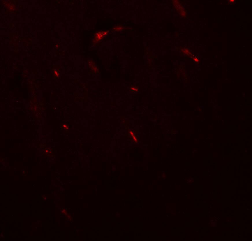 Immunocytochemistry/ Immunofluorescence: FOXG1 Antibody - BSA Free [NBP2-81942] - Immunofluorescence of FOXG1 in mouse brain tissue with FOXG1 antibody at 20 u/ml.