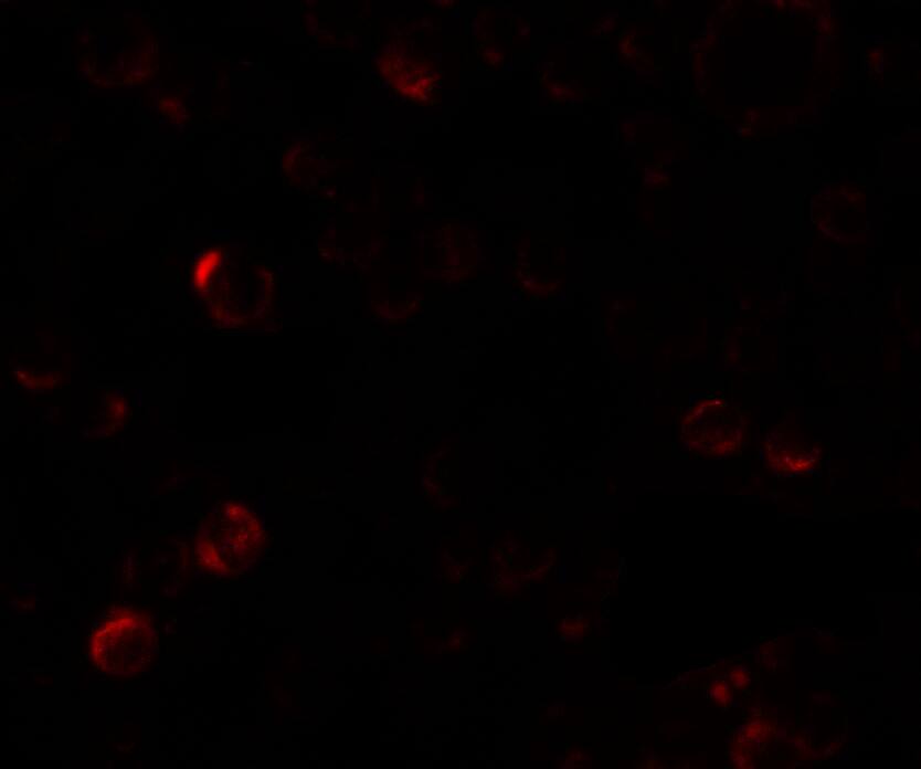 Immunocytochemistry/ Immunofluorescence: Laforin/EPM2A Antibody - BSA Free [NBP2-81945] - Immunofluorescence of Laforin/EPM2A in SW480 cells with Laforin/EPM2A antibody at 5 u/ml.