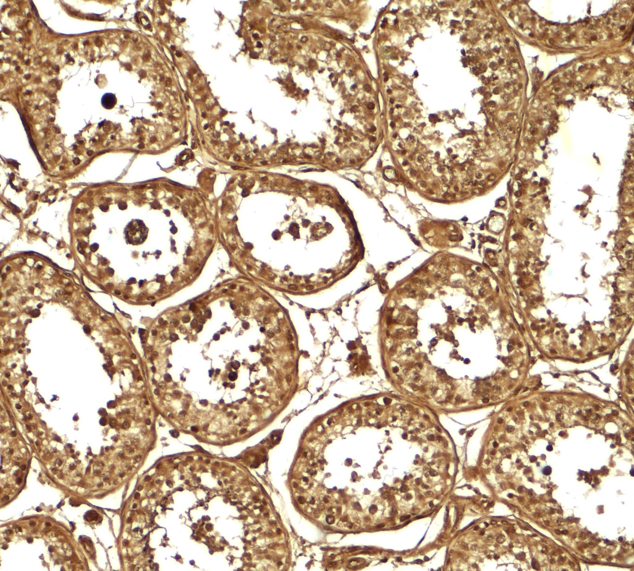 Immunohistochemistry: AKAP4 Antibody - BSA Free [NBP2-81946] - Immunohistochemistry of AKAP4 in human testis tissue with AKAP4 antibody at 5 u/ml.