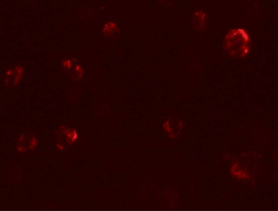 Immunocytochemistry/ Immunofluorescence: EIG121 Antibody - BSA Free [NBP2-81949] - Immunofluorescence of EIG121 in MCF7 cells with EIG121 antibody at 20 u/mL.