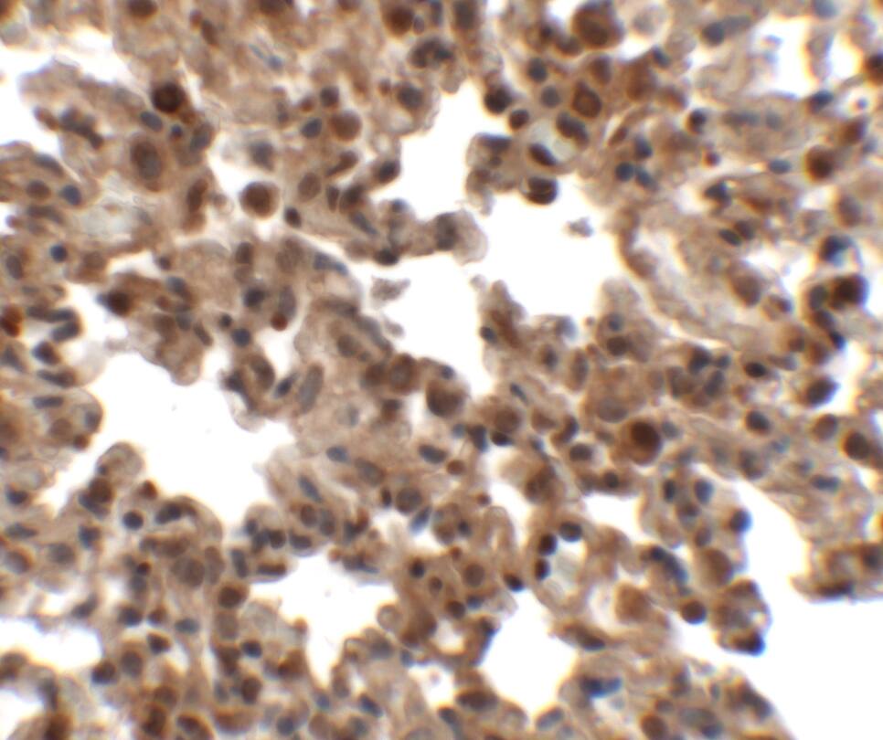 Immunohistochemistry: FXYD7 Antibody - BSA Free [NBP2-81950] - Immunohistochemistry of FXYD7 in rat lung tissue with FXYD7 antibody at 2.5 u/mL.