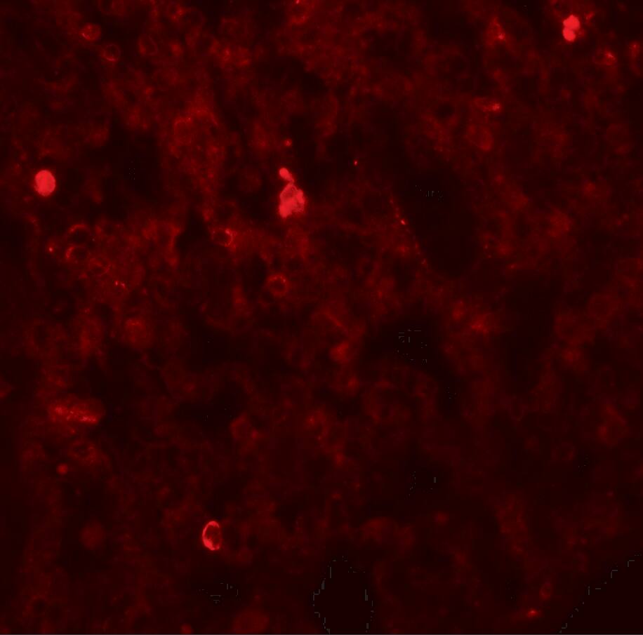 Immunocytochemistry/ Immunofluorescence: FXYD7 Antibody - BSA Free [NBP2-81950] - Immunofluorescence of FXYD4 in rat lung tissue with FXYD4 antibody at 20 u/mL.