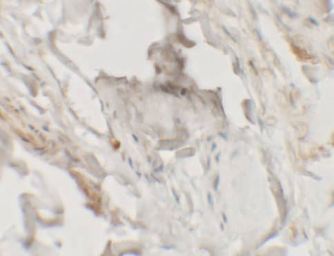 Immunohistochemistry HHATL Antibody - BSA Free