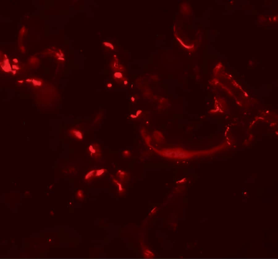 Immunocytochemistry/ Immunofluorescence: HHATL Antibody - BSA Free [NBP2-81952] - Immunofluorescence of HHATL in human skin tissue with HHATL antibody at 20 u/mL.
