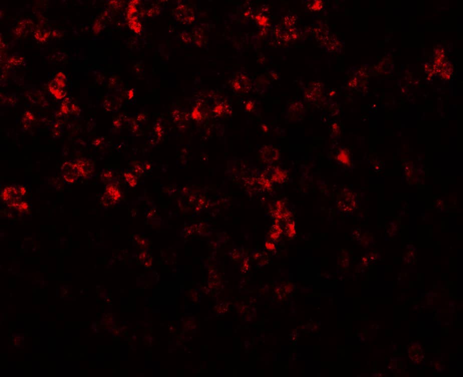 Immunocytochemistry/ Immunofluorescence: MKRN3 Antibody - BSA Free [NBP2-81964] - Immunofluorescence of MKRN3 in human spleen tissue with MKRN3 antibody at 20 ug/mL.