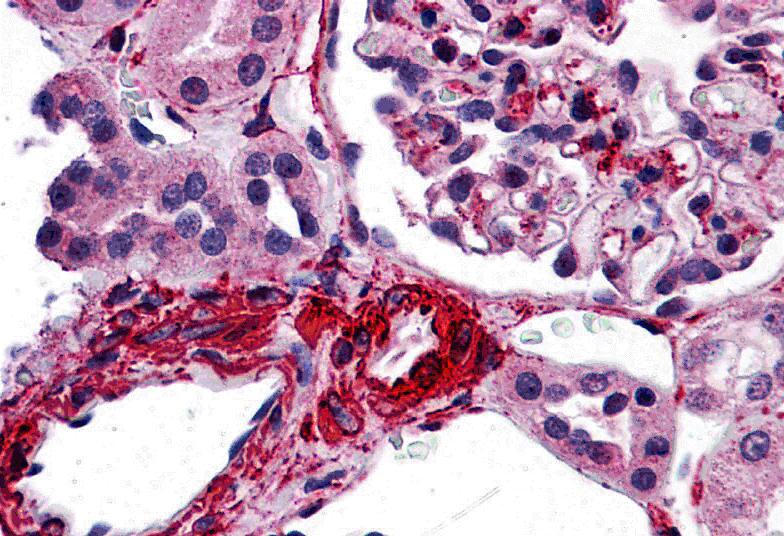 Immunohistochemistry: CARD10 Antibody - BSA Free [NBP2-81970] - Immunohistochemistry of CARD10 in human kidney tissue with CARD10 antibody at 5 ug/ml