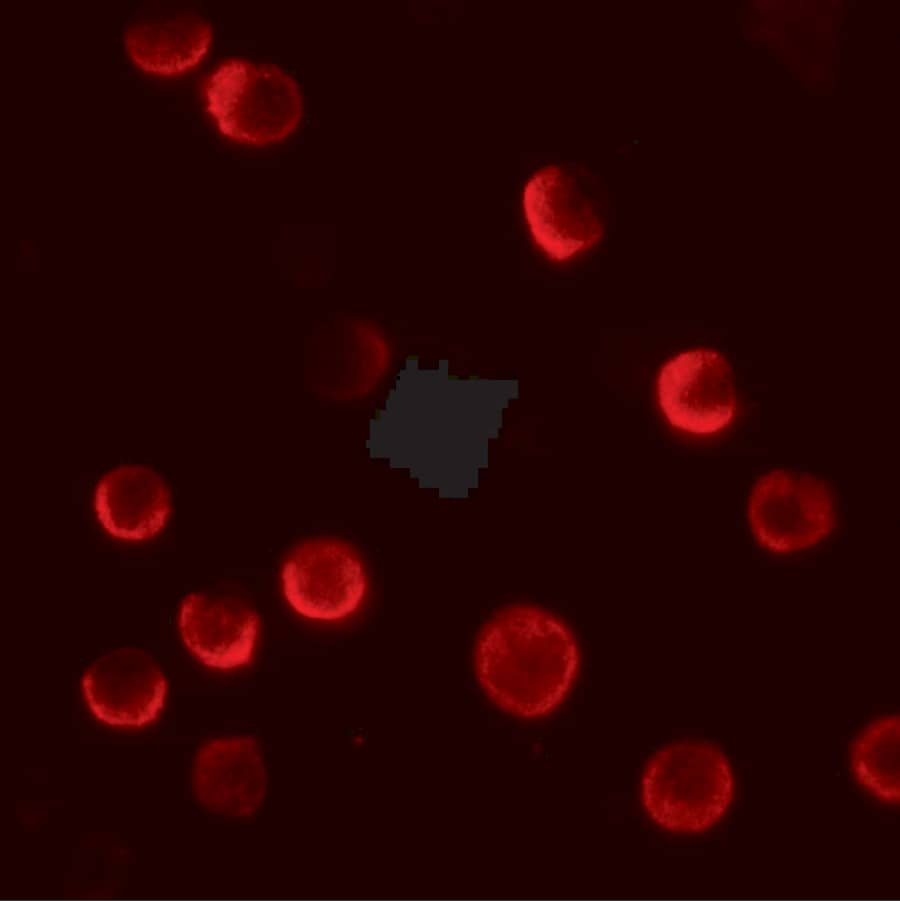 Immunocytochemistry/ Immunofluorescence: CASKIN2 Antibody - BSA Free [NBP2-81971] - Immunofluorescence of CASKIN2 in HeLa cells with CASKIN2 antibody at 20 u/mL.