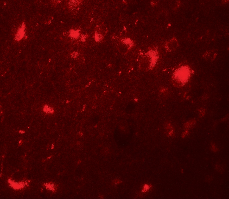 Immunocytochemistry/ Immunofluorescence: CBX4 Antibody - BSA Free [NBP2-81972] - Immunofluorescence of CBX4 in human brain tissue with CBX4 antibody at 20 ug/mL.