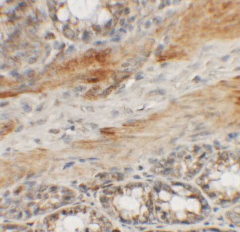 Immunohistochemistry: CCP110 Antibody - BSA Free [NBP2-81976] - Immunohistochemistry of CCP110 in rat colon tissue with CCP110 antibody at 5 u/mL.