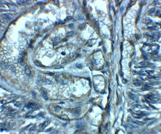 Immunohistochemistry: ENT2 Antibody - BSA Free [NBP2-81984] - Immunohistochemistry of ENT2 in human bladder tissue with ENT2 antibody at 2.5 u/mL.