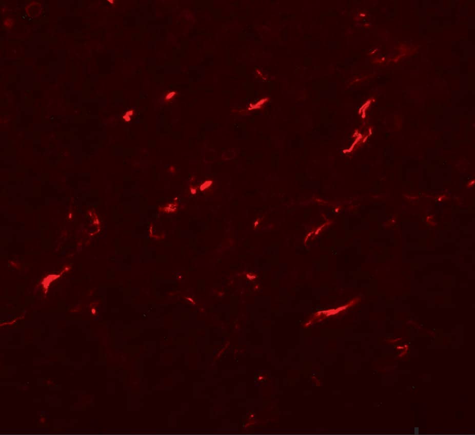 Immunocytochemistry/ Immunofluorescence FMNL1 Antibody - BSA Free