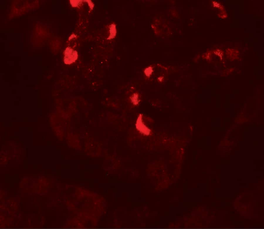 Immunocytochemistry/ Immunofluorescence GLIPR1L1 Antibody - BSA Free