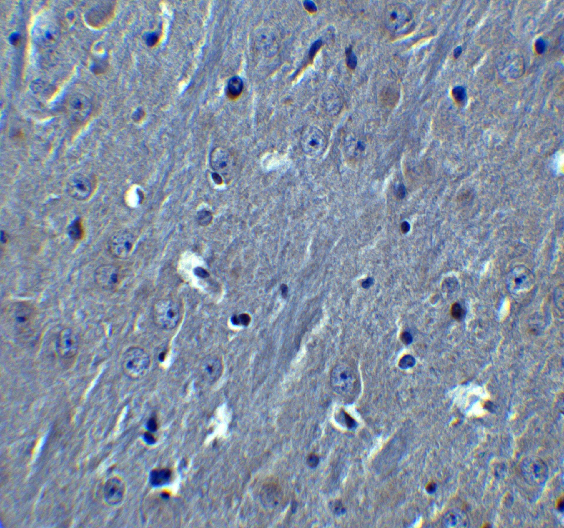 Immunohistochemistry: HOOK3 Antibody - BSA Free [NBP2-81990] - Immunohistochemistry of HOOK3 in mouse brain tissue with HOOK3 antibody at 10 u/ml.