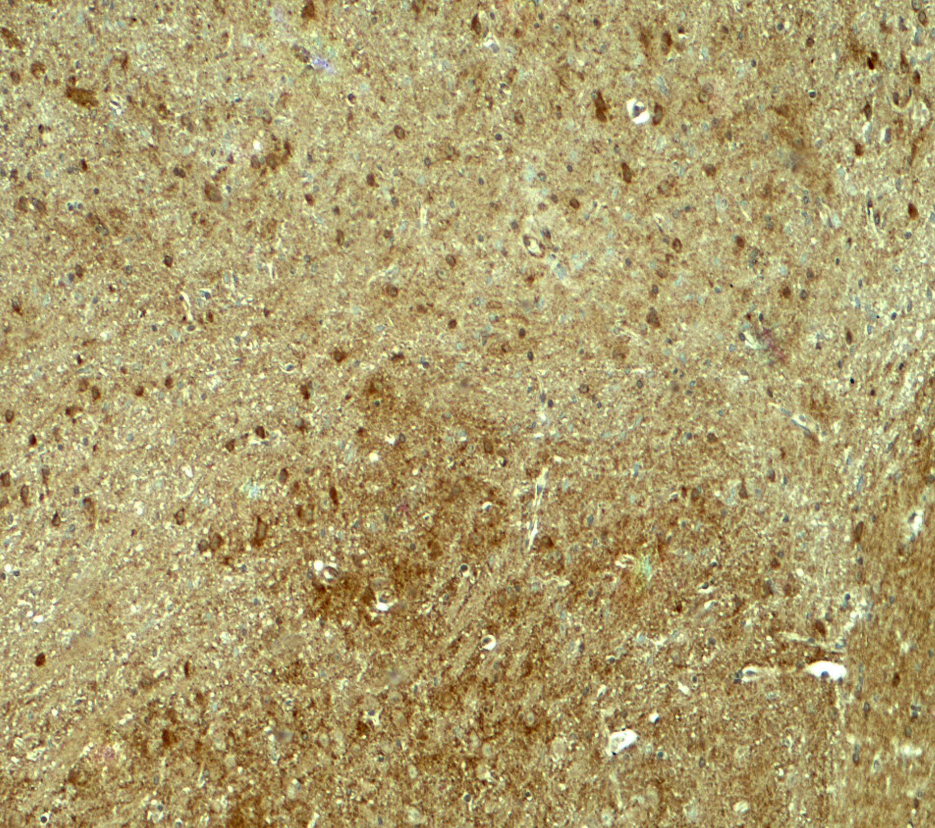 Immunohistochemistry: RNF70 Antibody - BSA Free [NBP2-81998] - Immunohistochemistry of RNF70 in mouse brain tissue with RNF70 antibody at 5 u/ml.