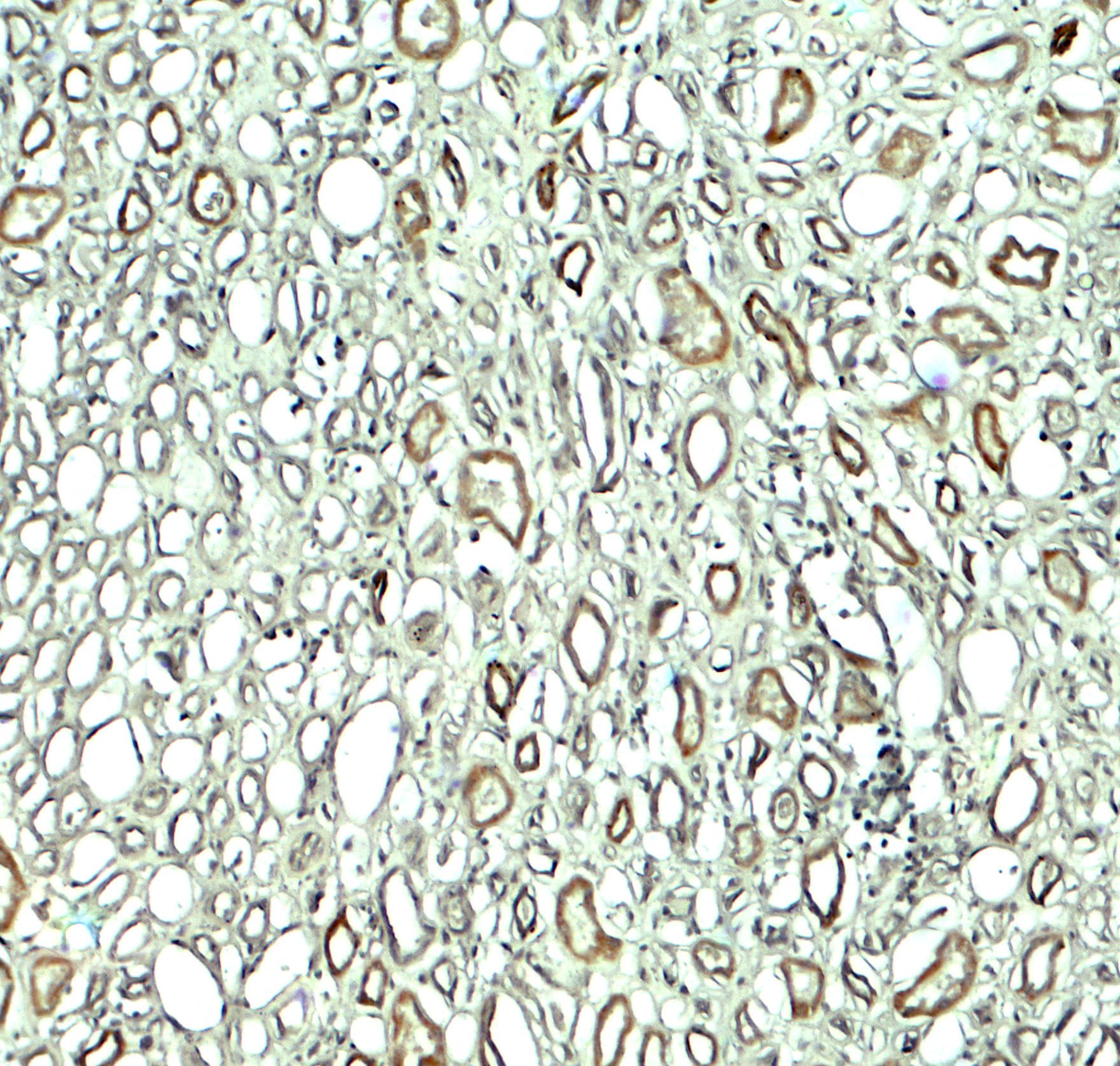 Immunohistochemistry: Rubicon Antibody - BSA Free [NBP2-81999] - Immunohistochemistry of Rubicon in human kidney tissue with Rubicon antibody at 5 u/ml.