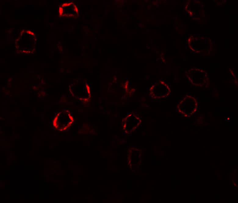 Immunocytochemistry/ Immunofluorescence Kirrel3/NEPH2 Antibody - BSA Free