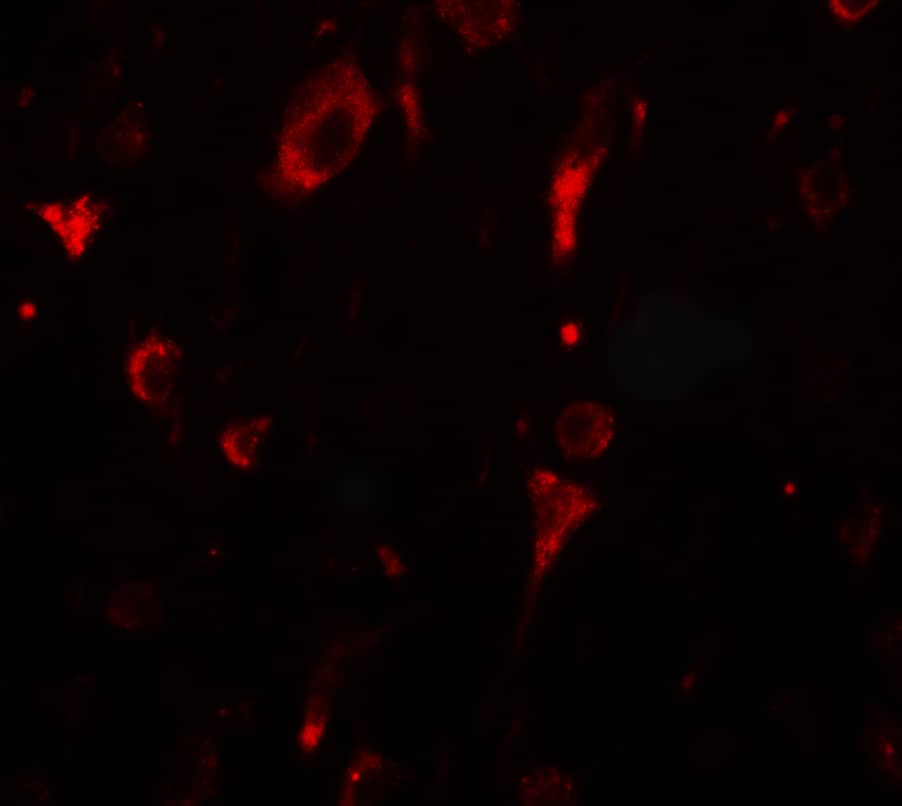 Immunocytochemistry/ Immunofluorescence: SGSM2 Antibody - BSA Free [NBP2-82004] - Immunofluorescence of SGSM2 in human brain tissue with SGSM2 antibody at 20 ug/mL.