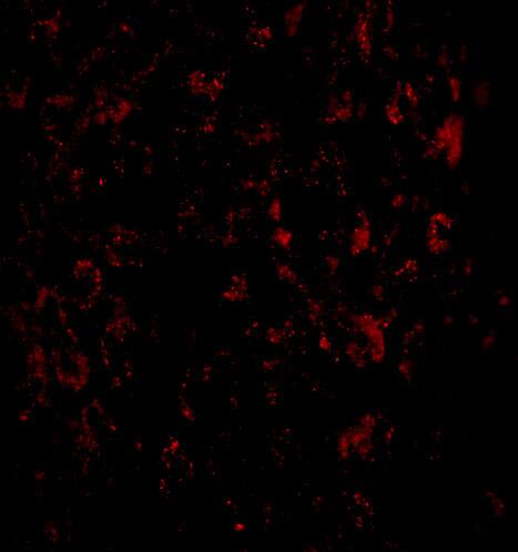 Immunocytochemistry/ Immunofluorescence: MACC1 Antibody - BSA Free [NBP2-82006] - Immunofluorescence of MACC1 in Human Liver cells with MACC1 antibody at 20 u/mL.