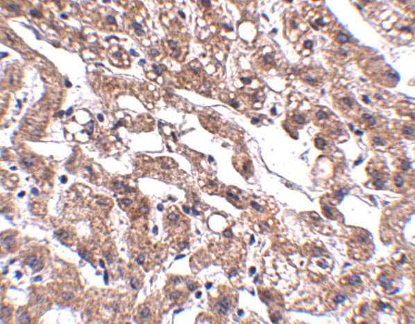 Immunohistochemistry: MACC1 Antibody - BSA Free [NBP2-82006] - Immunohistochemistry of MACC1 in human liver tissue with MACC1 antibody at 2.5 u/mL.