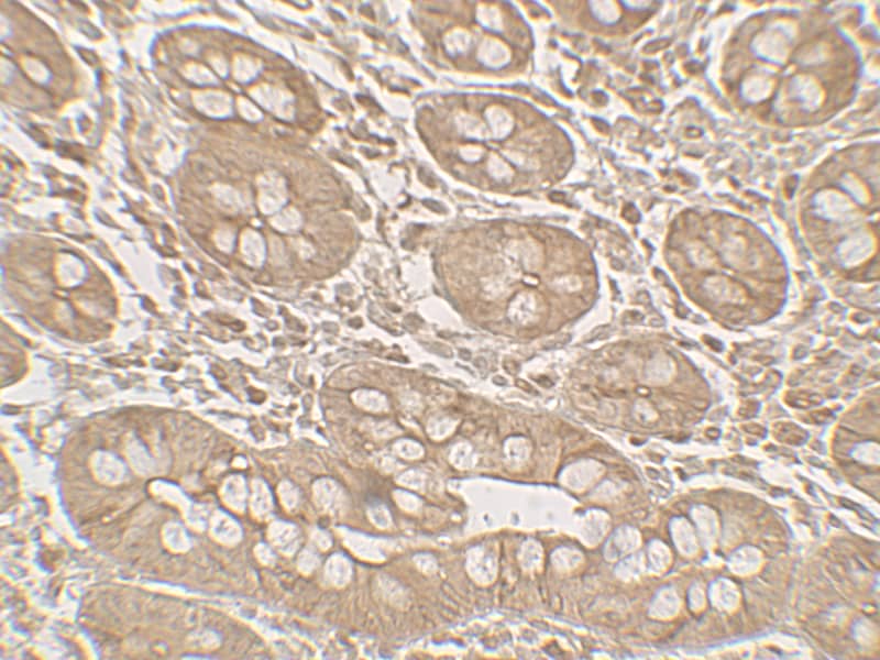 Immunohistochemistry: MIST1 Antibody - BSA Free [NBP2-82007] - Immunohistochemistry of MIST1 in human small intestine tissue with MIST1 antibody at 5 u/mL.