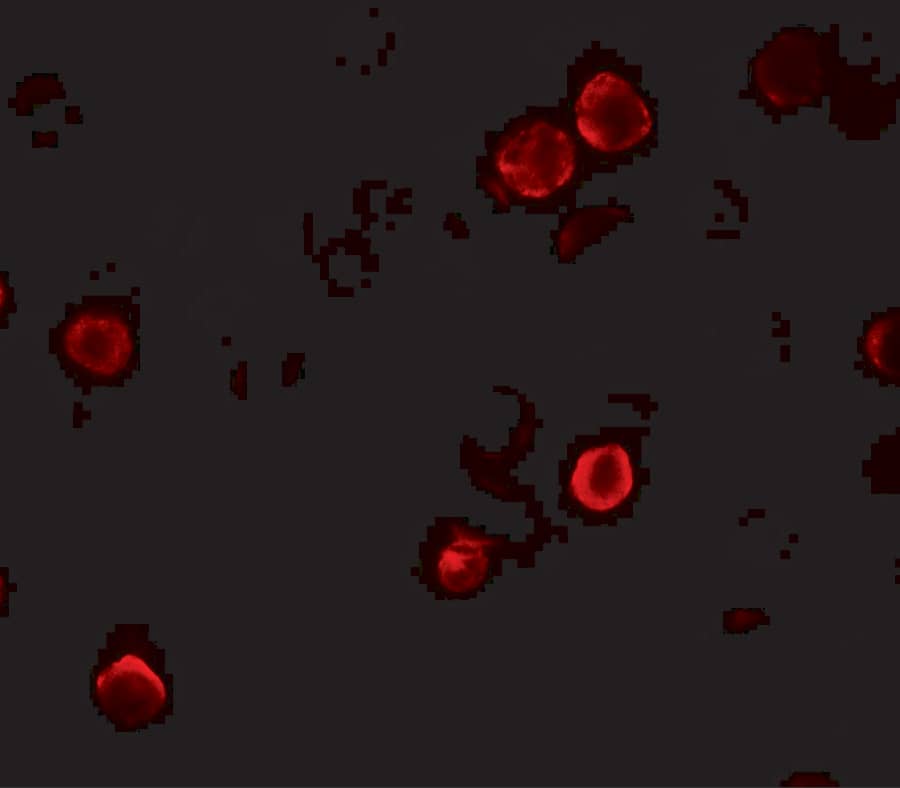Immunocytochemistry/ Immunofluorescence: SPACA9 Antibody - BSA Free [NBP2-82011] - Immunofluorescence of SPACA9 in HeLa cells with SPACA9 antibody at 5 u/mL.
