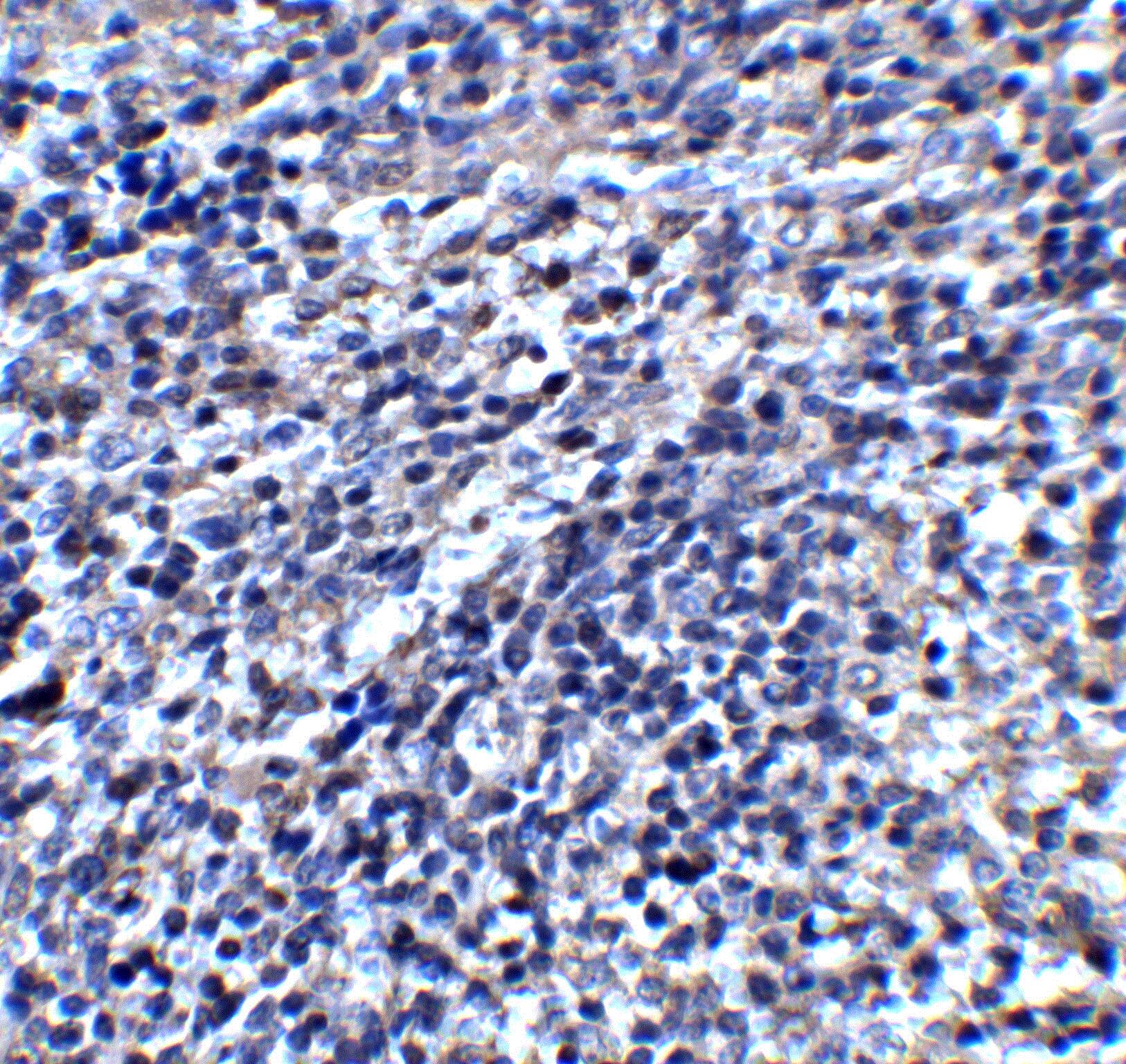 Immunohistochemistry: ORAI3 Antibody - BSA Free [NBP2-82013] - Immunohistochemistry of ORAI3 in mouse spleen tissue with ORAI3 antibody at 2 u/mL.