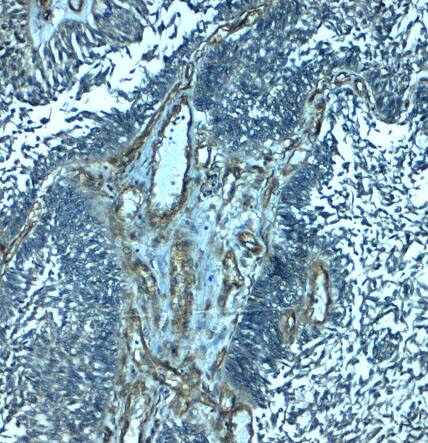 Immunohistochemistry: PALMD Antibody - BSA Free [NBP2-82018] - Immunohistochemistry of PALMD in human bladder tissue with PALMD antibody at 2.5 ug/mL.