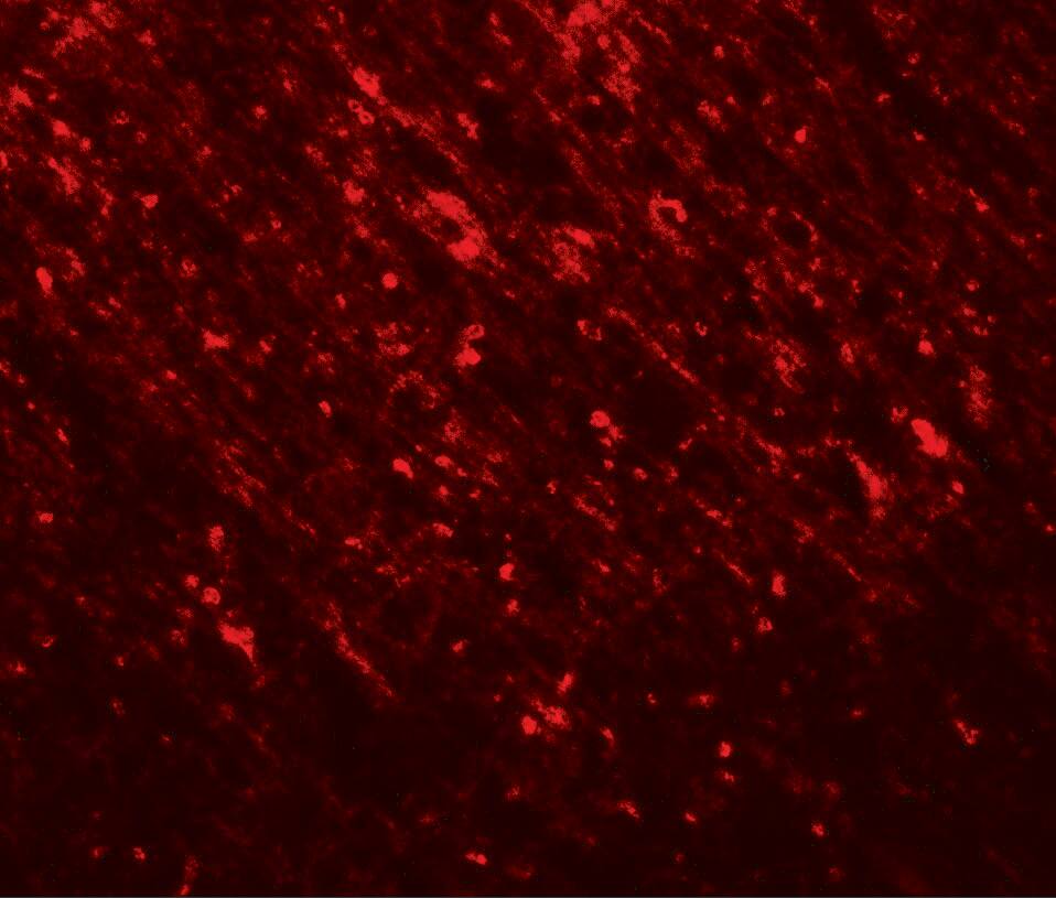 Immunocytochemistry/ Immunofluorescence TLX2 Antibody - BSA Free