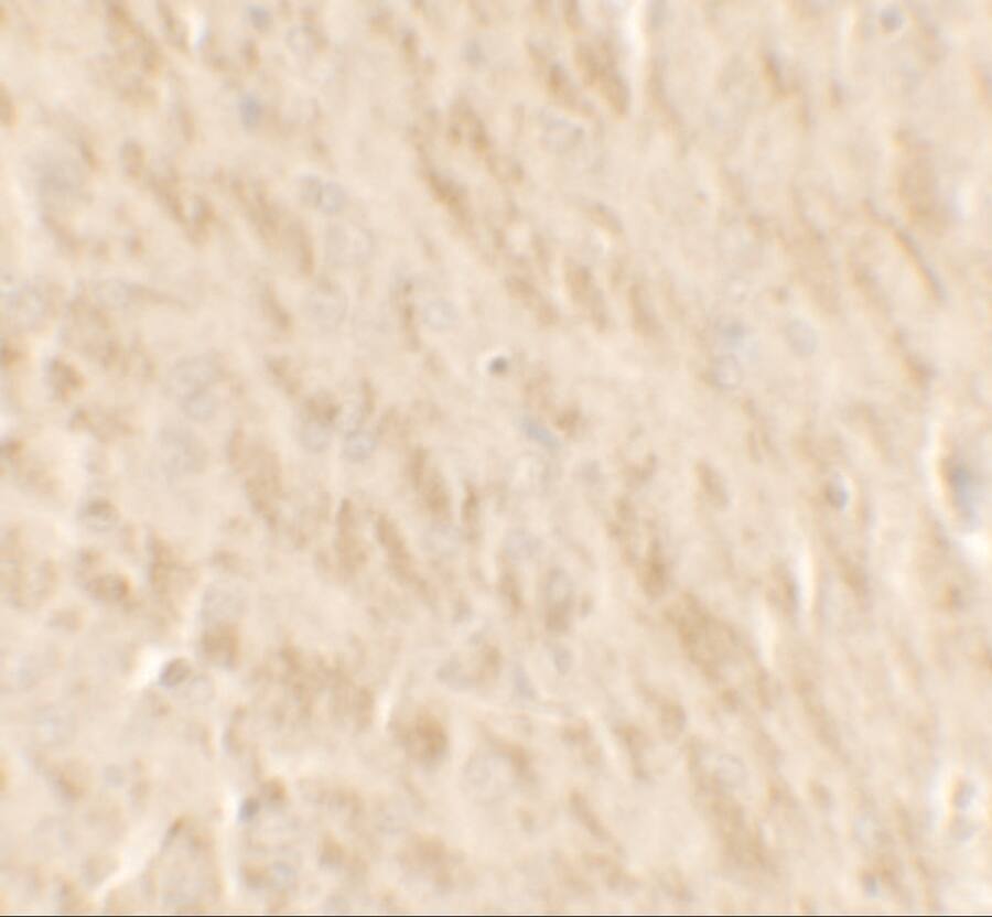 Immunohistochemistry TLX2 Antibody - BSA Free