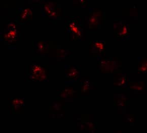 Immunocytochemistry/ Immunofluorescence: PRR5L Antibody - BSA Free [NBP2-82025] - Immunofluorescence of PPR5L in3T3 cells with PPR5L antibody at 20 ug/mL.