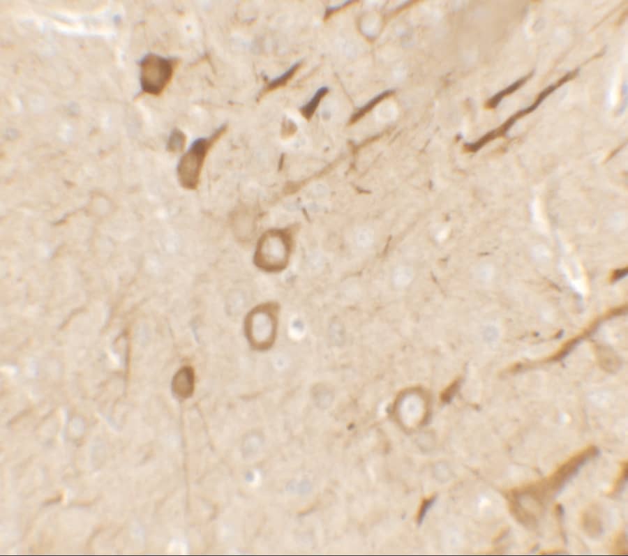 Immunohistochemistry PRRT2 Antibody - BSA Free