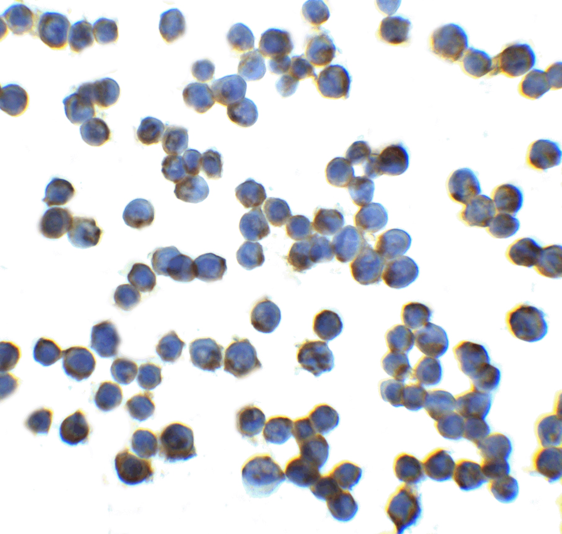 Immunocytochemistry/ Immunofluorescence RFX1 Antibody - BSA Free