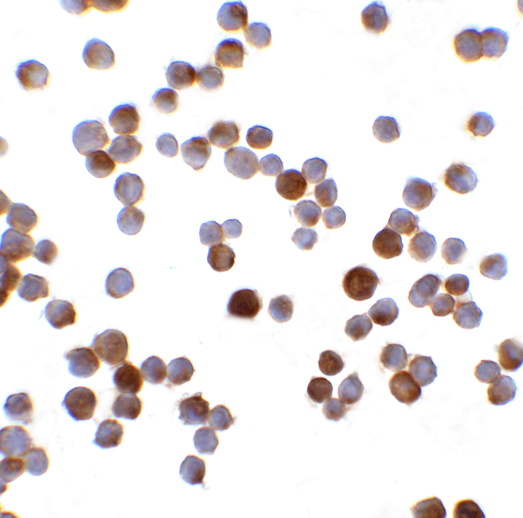 Immunocytochemistry/ Immunofluorescence RFX1 Antibody - BSA Free