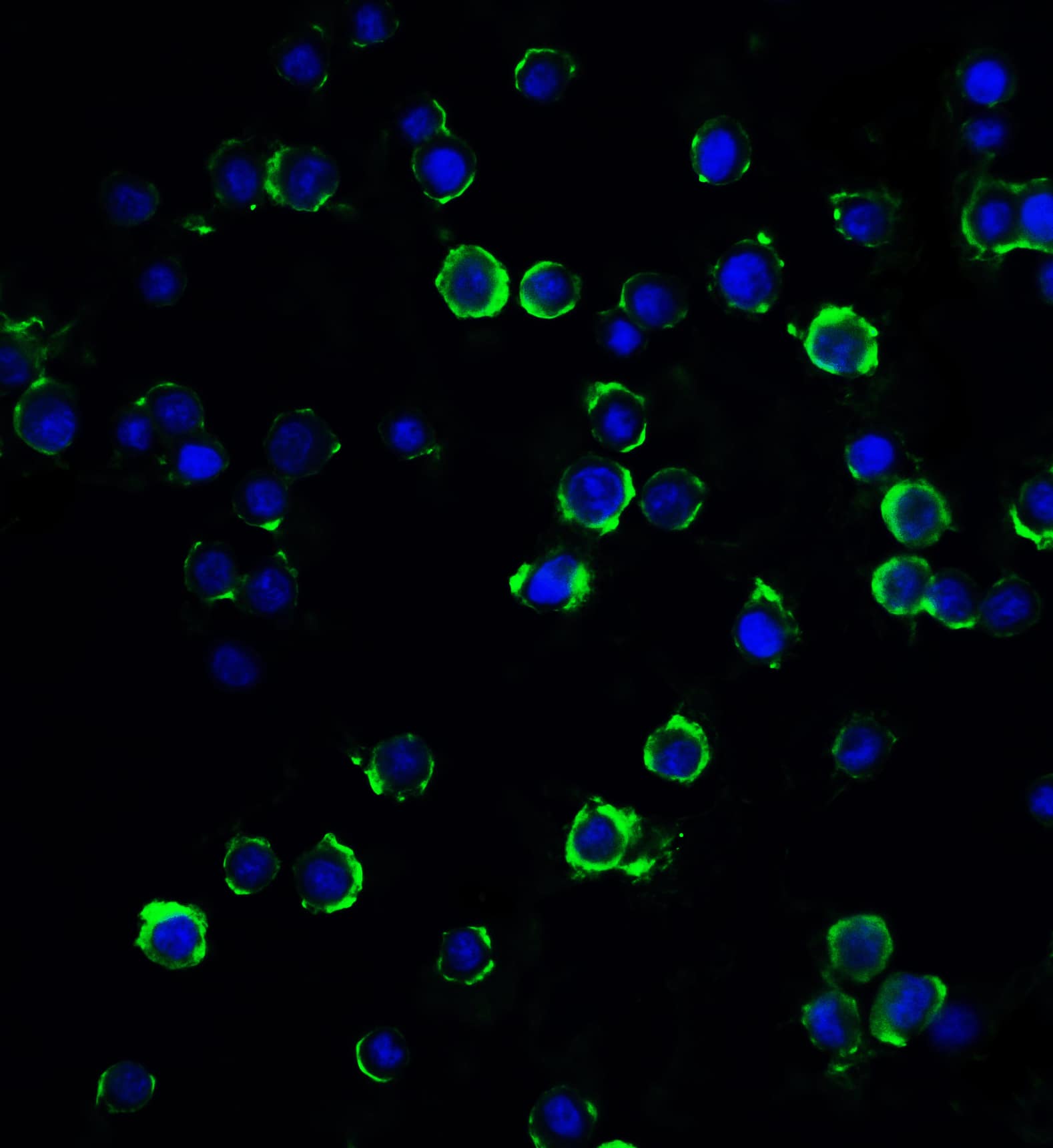 Immunocytochemistry/ Immunofluorescence RFX1 Antibody - BSA Free
