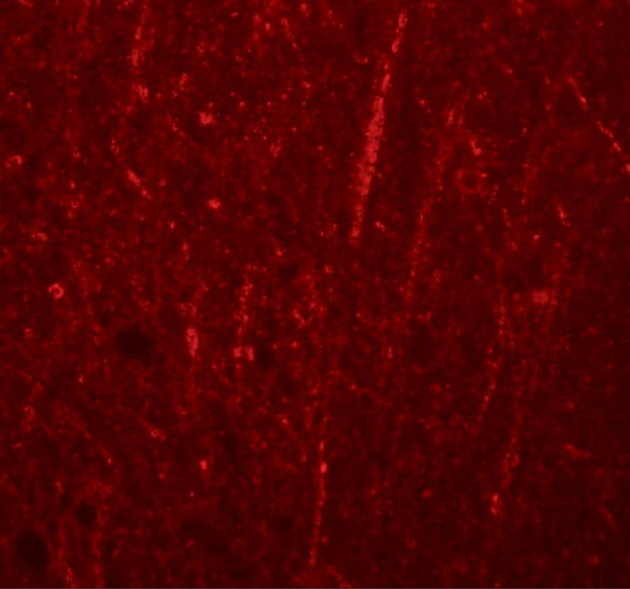 Immunocytochemistry/ Immunofluorescence: Preso/FRMPD4 Antibody - BSA Free [NBP2-82035] - Immunofluorescence of Preso/FRMPD4 in human brain tissue with Preso/FRMPD4 antibody at 20 ug/mL.