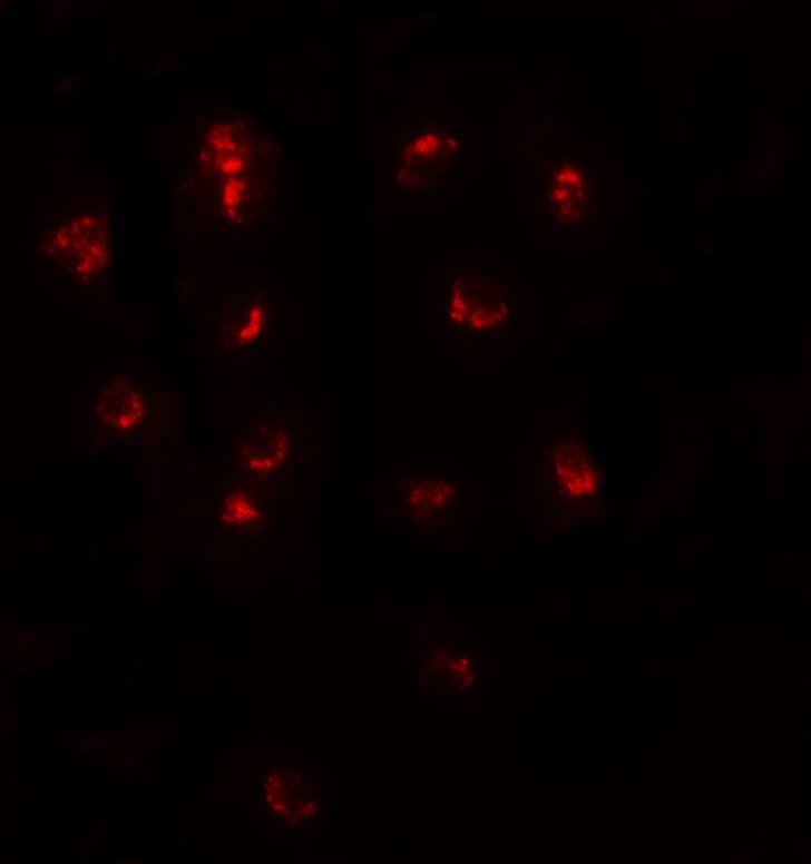 Immunocytochemistry/ Immunofluorescence: Teashirt homolog 1 Antibody - BSA Free [NBP2-82038] - Immunofluorescence of Teashirt homolog 1 in A20 cells with Teashirt homolog 1 antibody at 20 ug/mL.