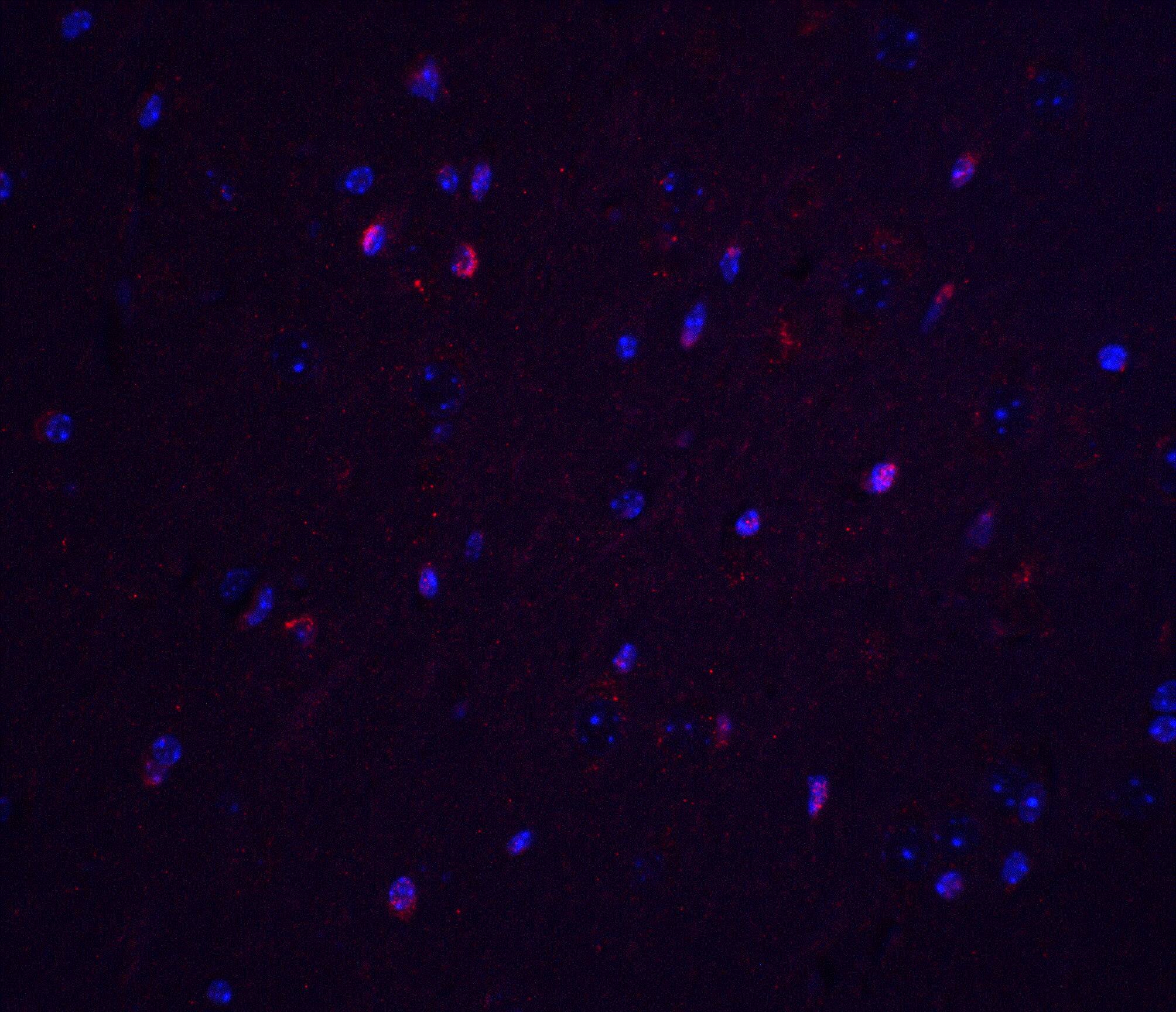 Immunocytochemistry/ Immunofluorescence: TNFAIP1 Antibody - BSA Free [NBP2-82039] - Immunofluorescence of TNFAIP1 in mouse brain tissue with TNFAIP1 antibody at 20 u/ml.Red: TNFAIP1 Antibody   Blue: DAPI staining