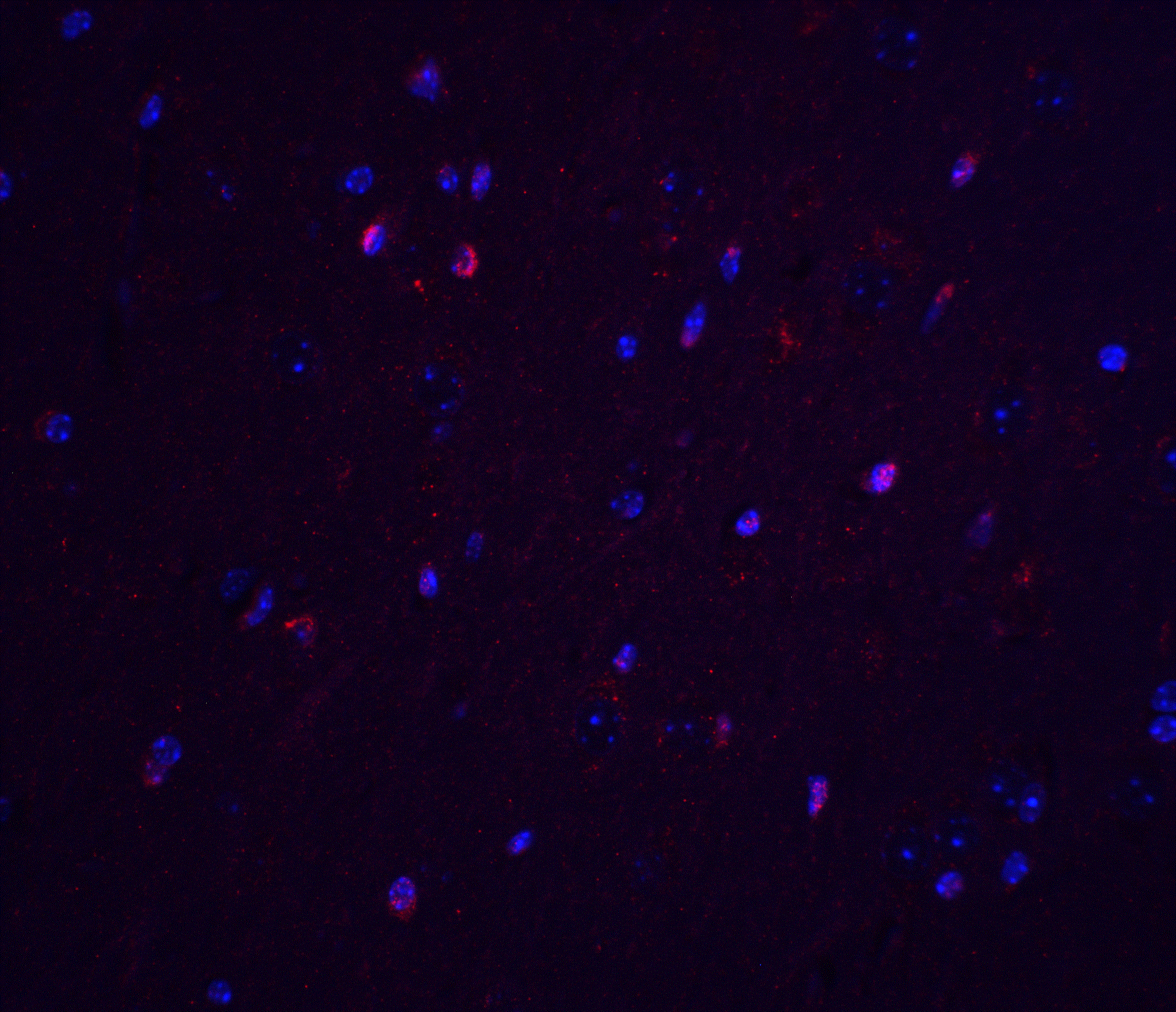 Immunocytochemistry/ Immunofluorescence: TNFAIP1 Antibody - BSA Free [NBP2-82039] - Immunofluorescence of TNFAIP1 in mouse brain tissue with TNFAIP1 antibody at 20 u/ml.Red: TNFAIP1 Antibody   Blue: DAPI staining