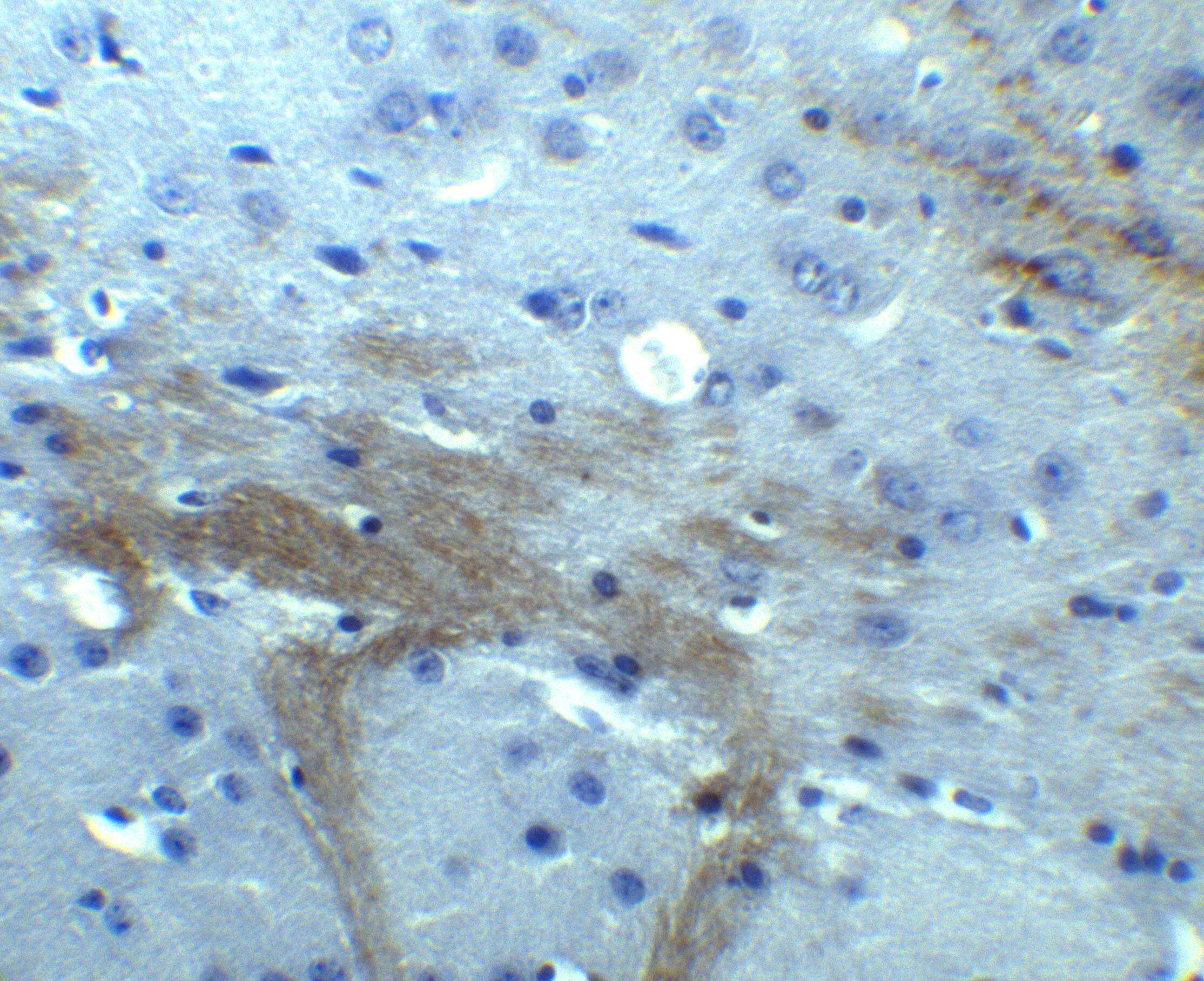 Immunohistochemistry: TNFAIP1 Antibody - BSA Free [NBP2-82039] - Immunohistochemistry of TNFAIP1 in mouse brain tissue with TNFAIP1 antibody at 10 u/ml.