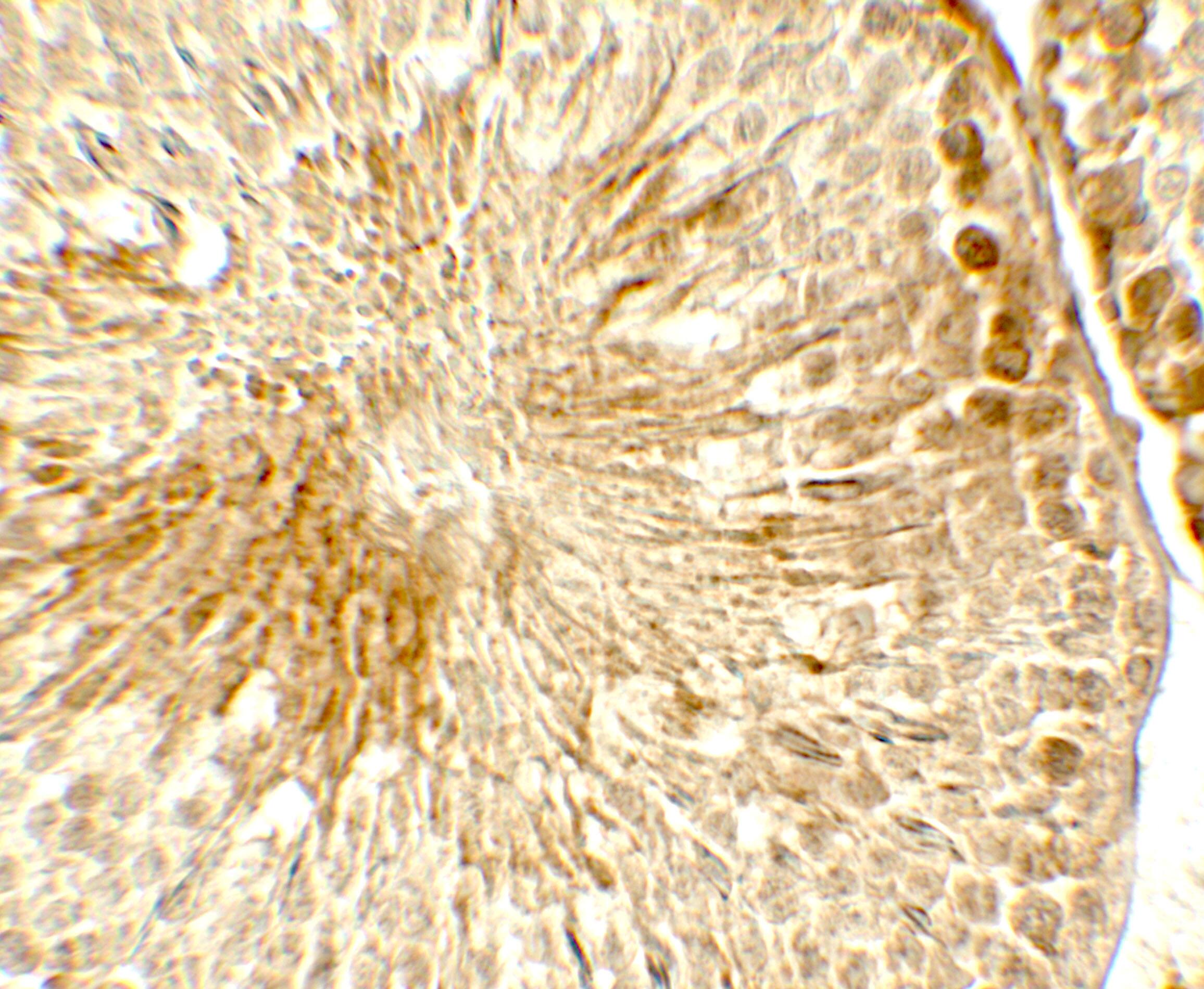 Immunohistochemistry TOPAZ1 Antibody - BSA Free