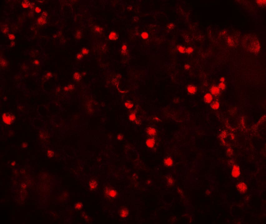 Immunocytochemistry/ Immunofluorescence TOPAZ1 Antibody - BSA Free