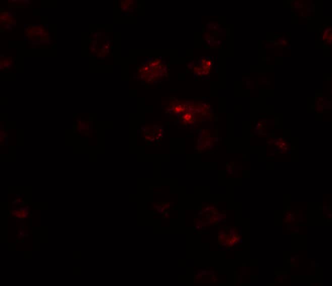 Immunocytochemistry/ Immunofluorescence TSHZ2 Antibody - BSA Free