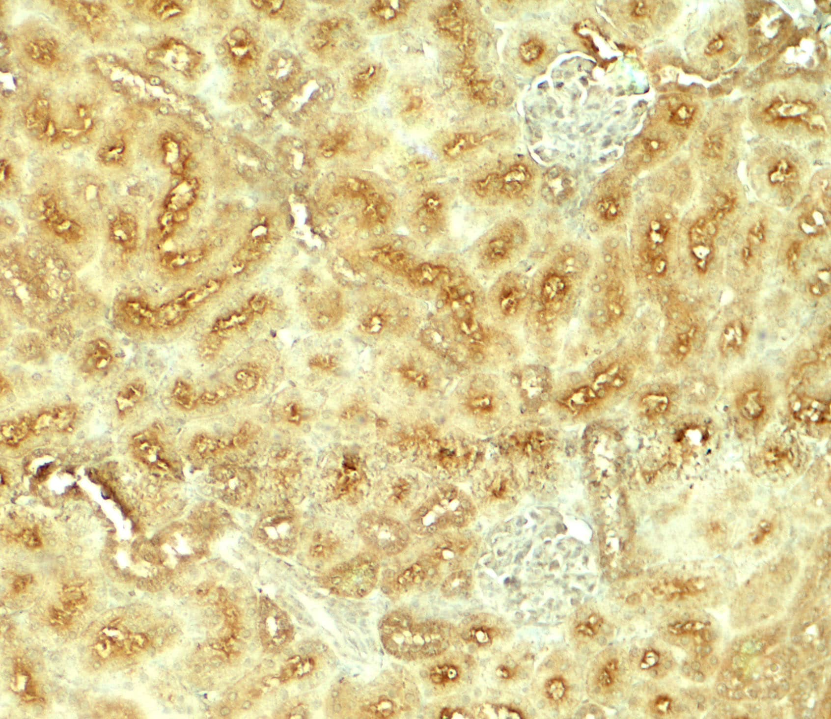Immunohistochemistry: VEZT Antibody - BSA Free [NBP2-82044] - Immunohistochemistry of VEZT in rat kidney tissue with VEZT antibody at 5 ug/ml.