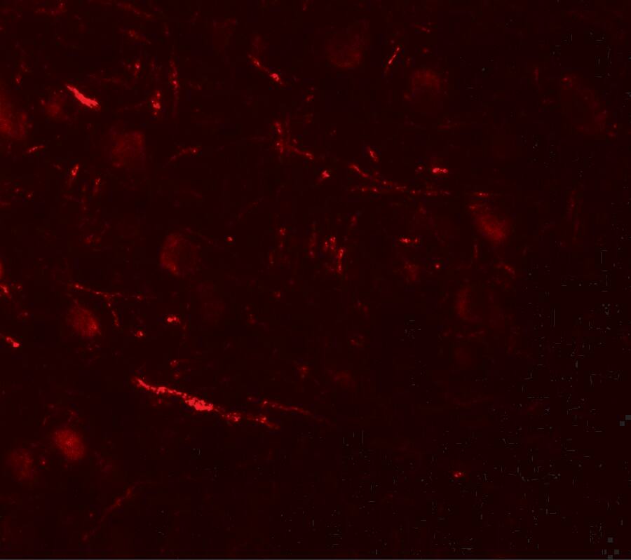 Immunocytochemistry/ Immunofluorescence: VPS13B Antibody - BSA Free [NBP2-82052] - Immunofluorescence of VPS13B in human brain tissue with VPS13B antibody at 20 ug/mL.