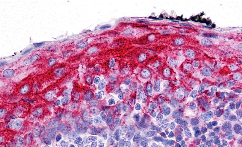 Immunohistochemistry: ZMYM4 Antibody - BSA Free [NBP2-82054] - Immunohistochemistry of ZMYM4 in human tonsil with ZMYM4 antibody at 5 ug/mL.