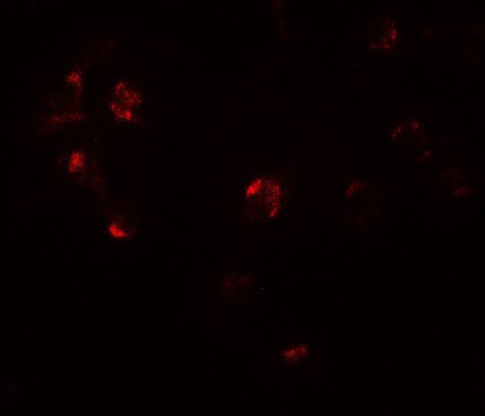 Immunocytochemistry/ Immunofluorescence: ZNF821 Antibody - BSA Free [NBP2-82055] - Immunofluorescence ofZNF821 in Jurkat cells with ZNF821 antibody at 20 ug/mL.